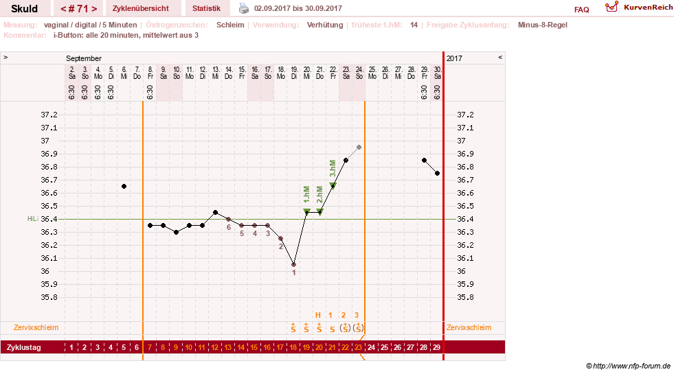 NFP-Kurve User #19086