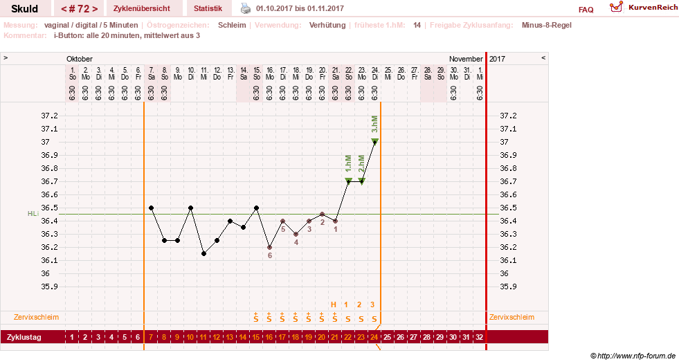 NFP-Kurve User #19086