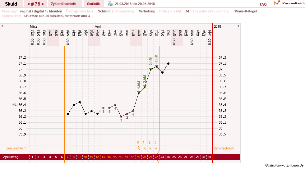 NFP-Kurve User #19086