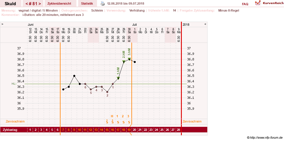 NFP-Kurve User #19086