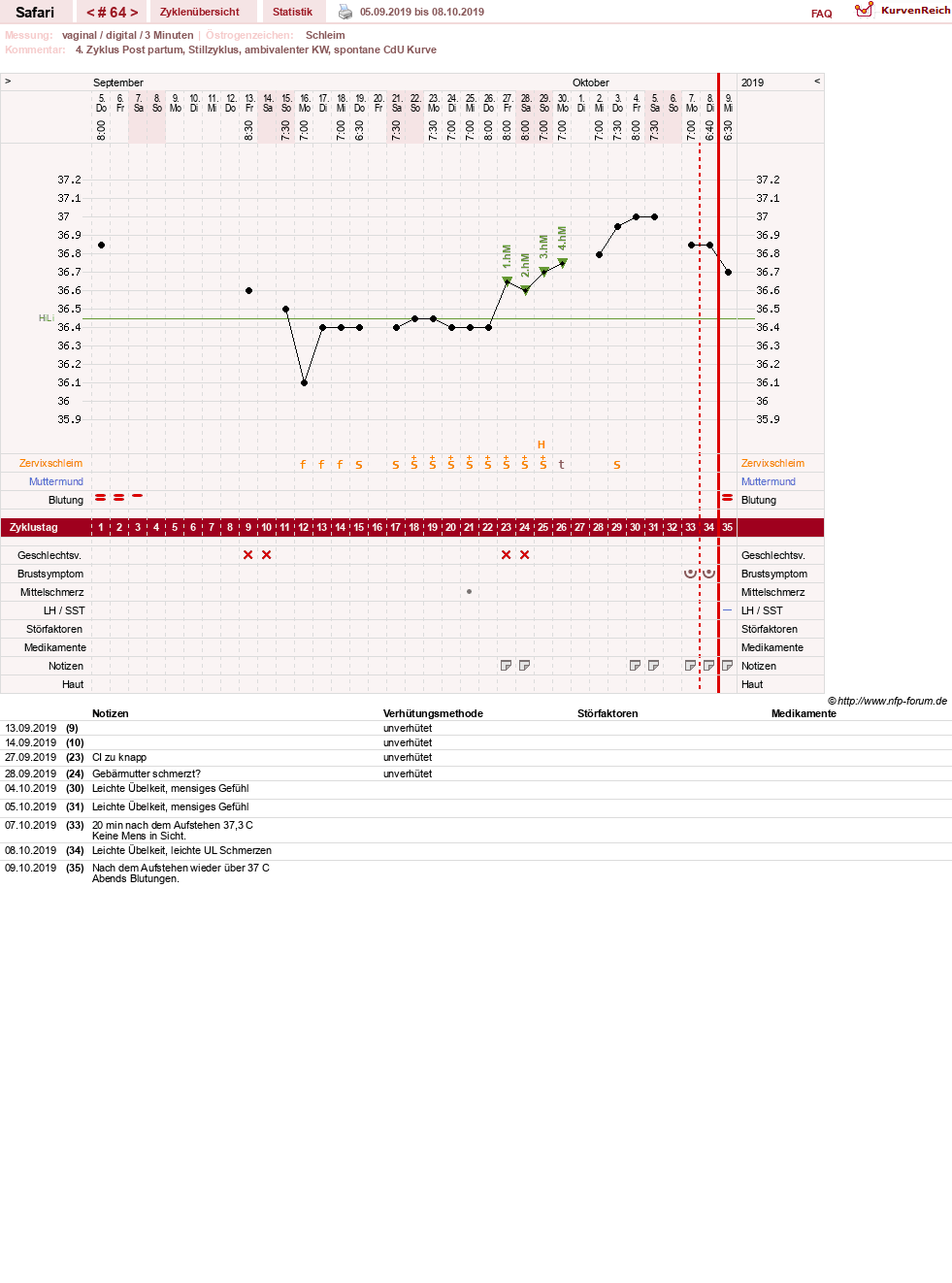 NFP-Kurve User #19153