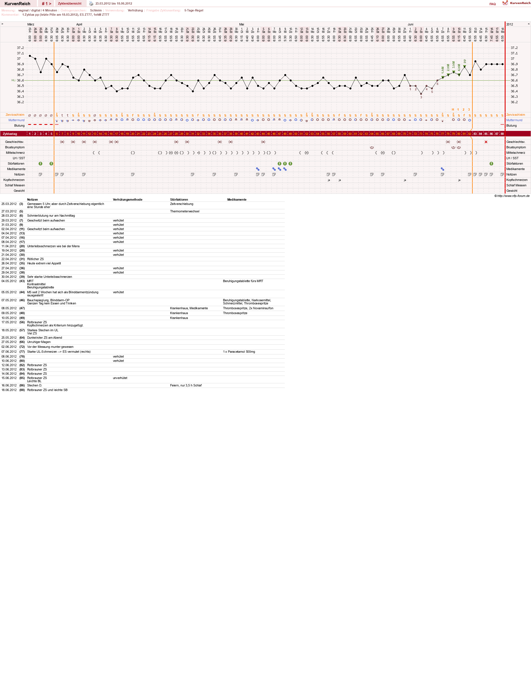 NFP-Kurve User #19178