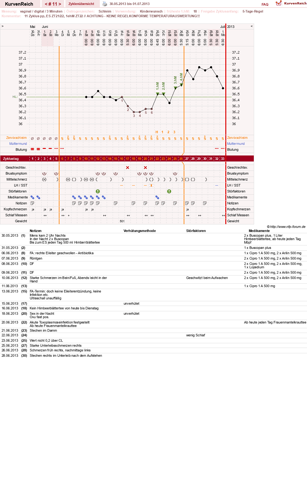 NFP-Kurve User #19178