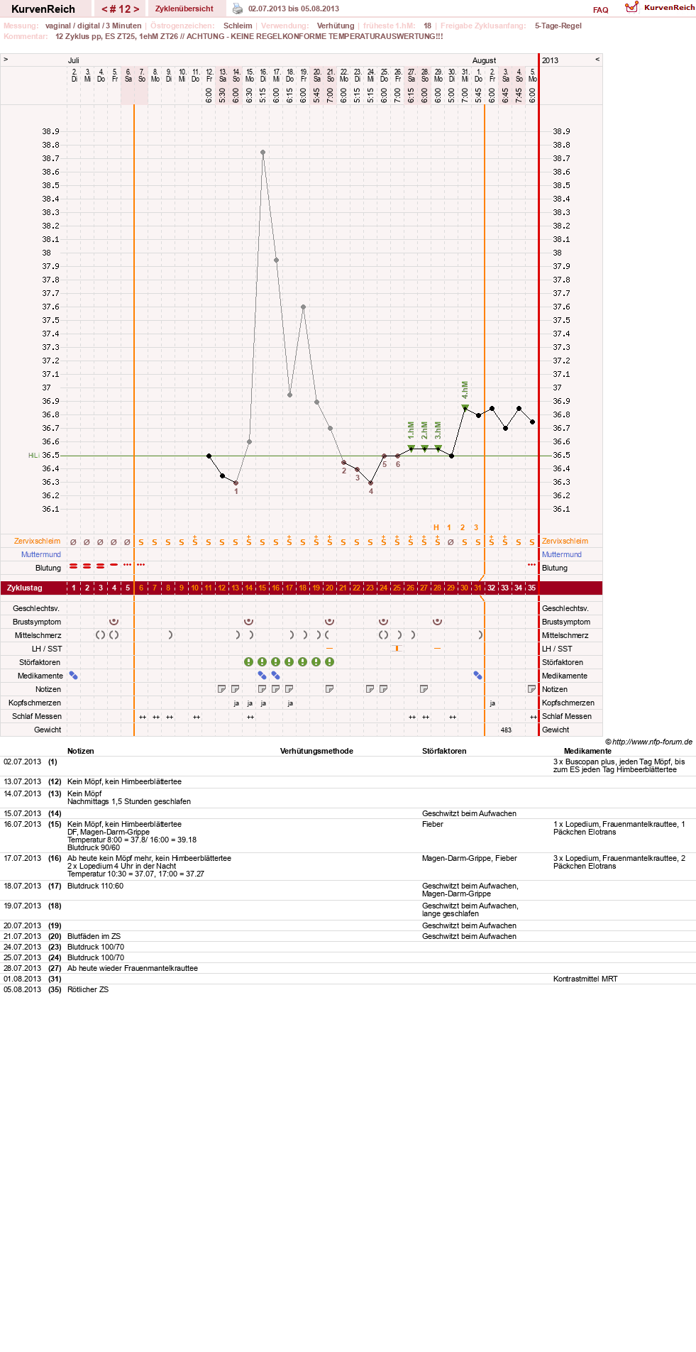 NFP-Kurve User #19178