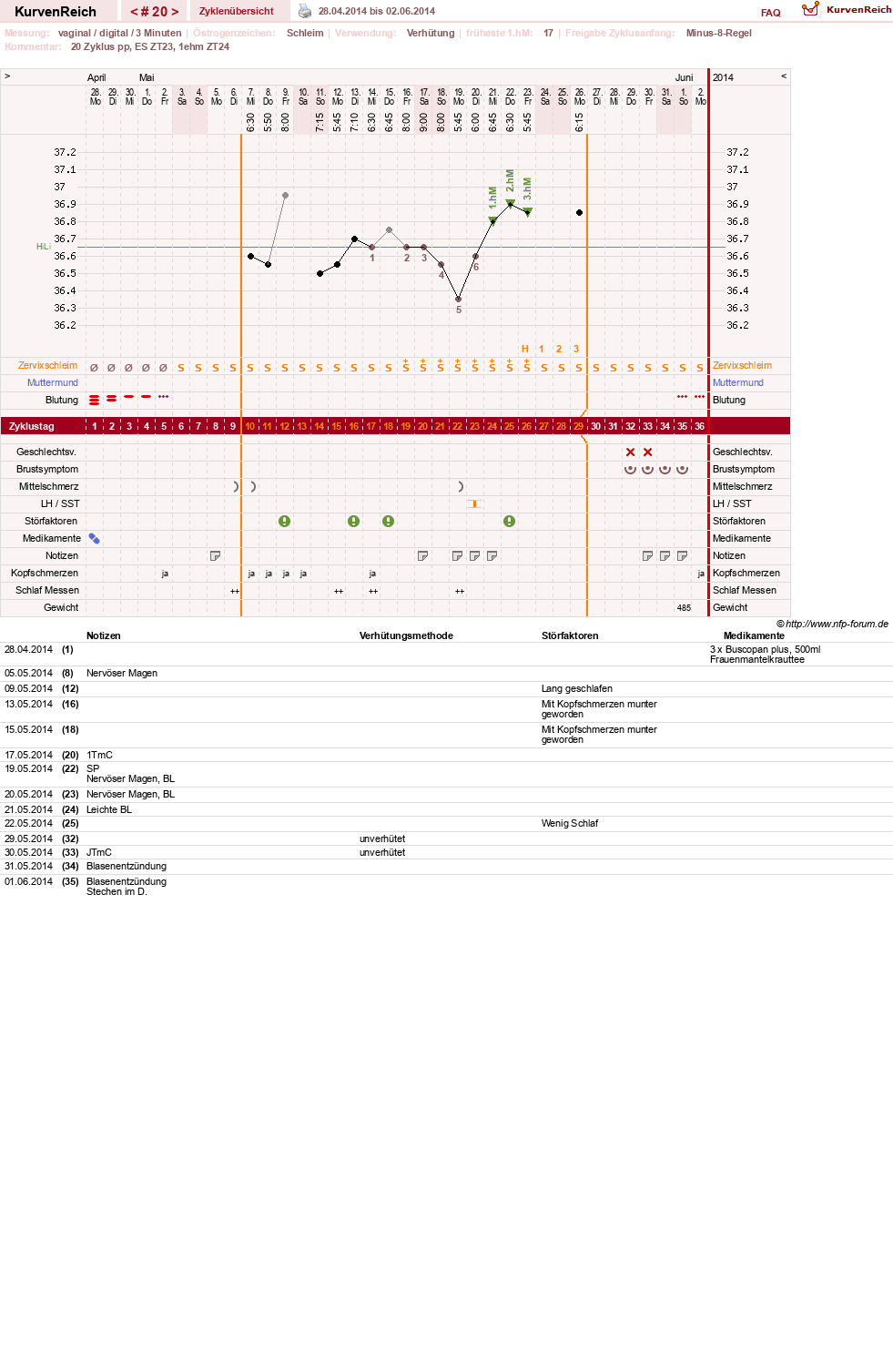 NFP-Kurve User #19178