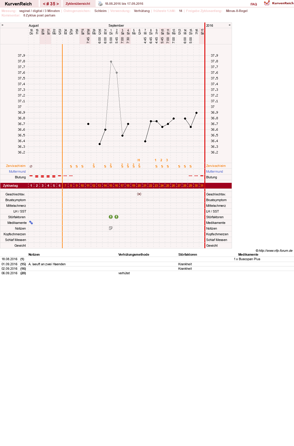 NFP-Kurve User #19178