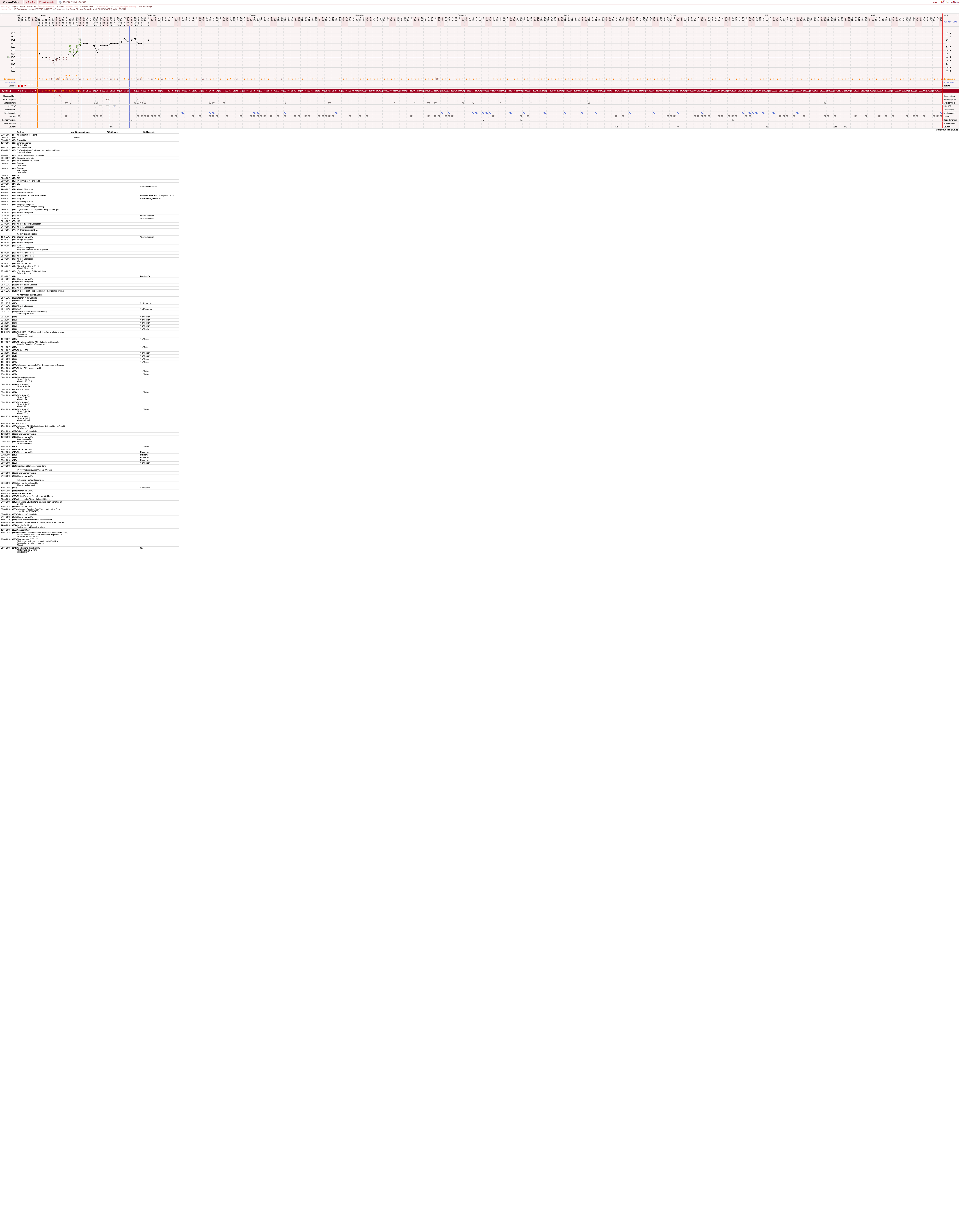 NFP-Kurve User #19178