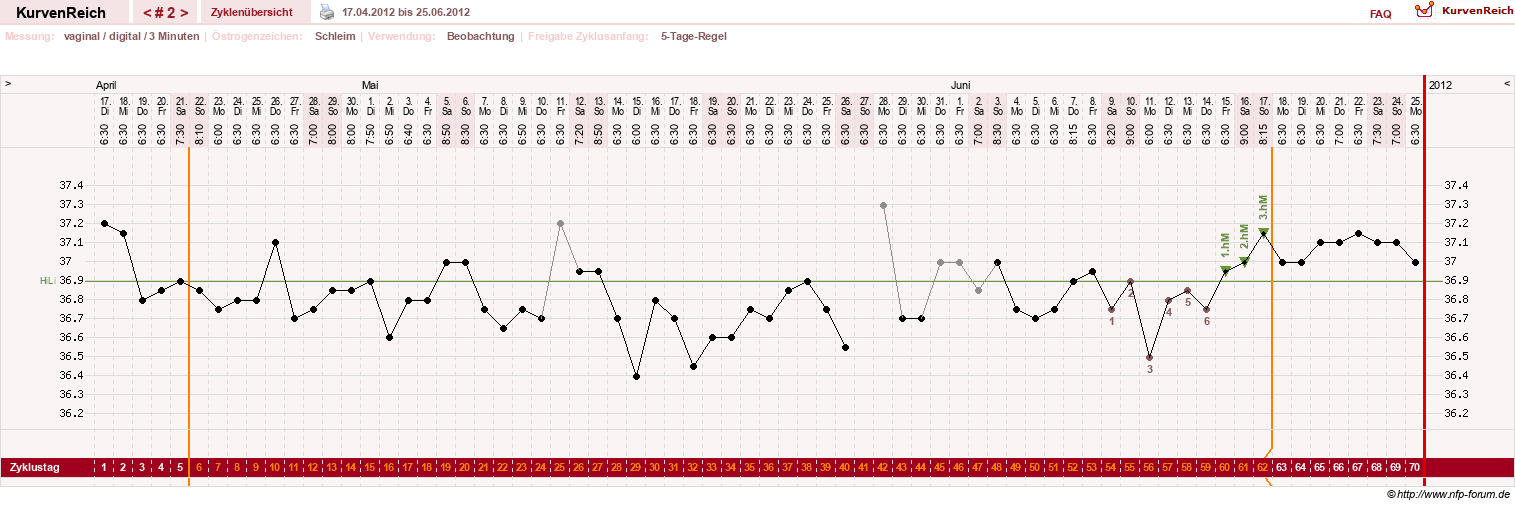 NFP-Kurve User #19247