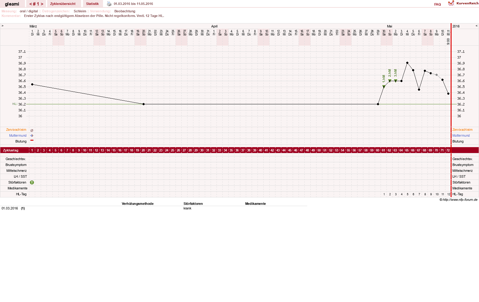 NFP-Kurve User #19314