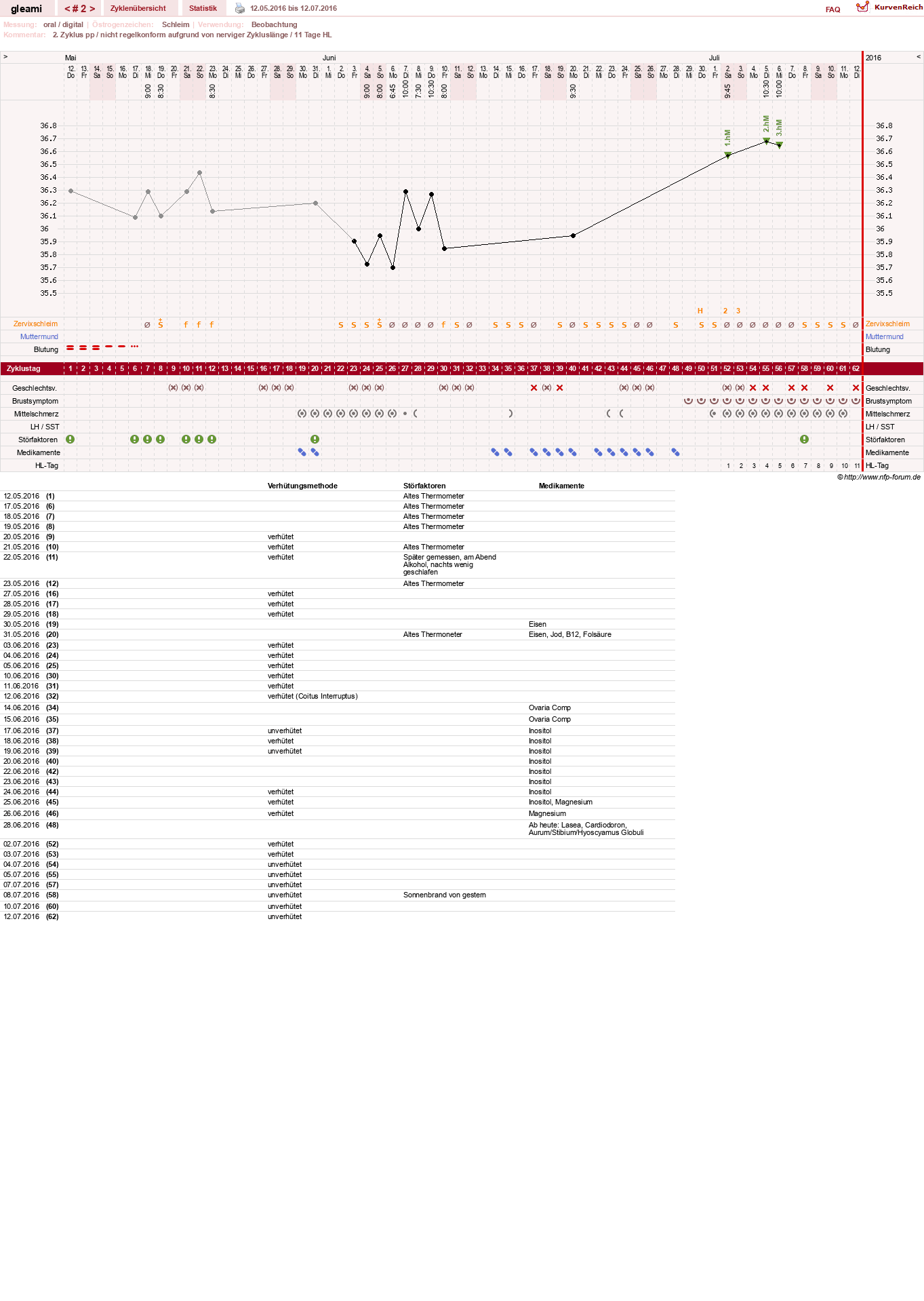 NFP-Kurve User #19314