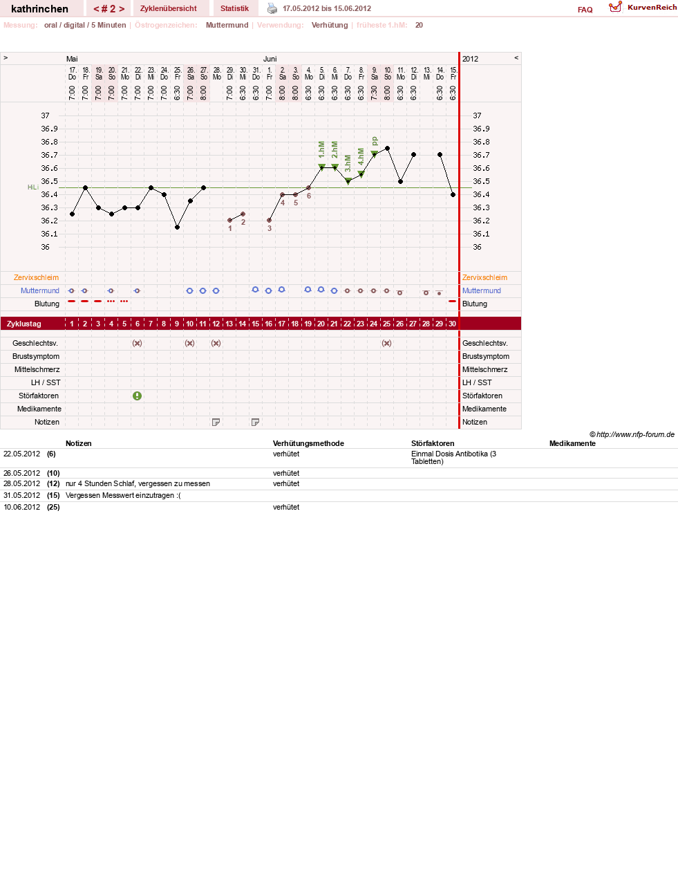 NFP-Kurve User #19425