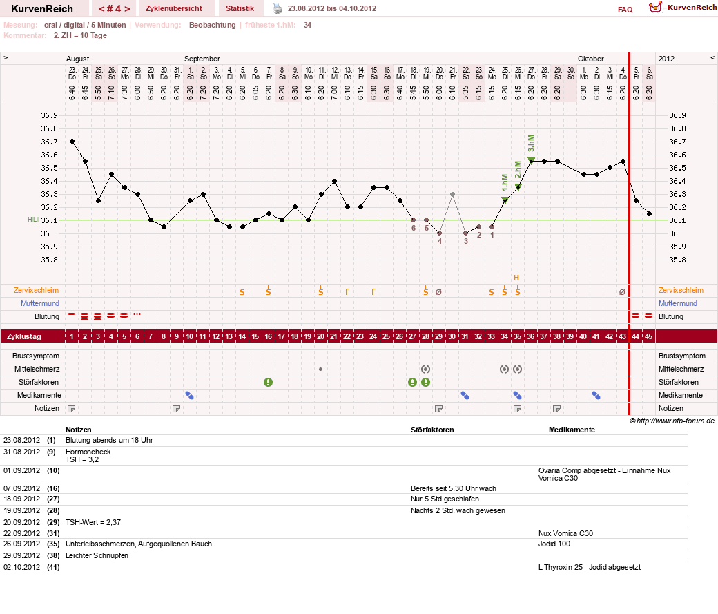NFP-Kurve User #19449