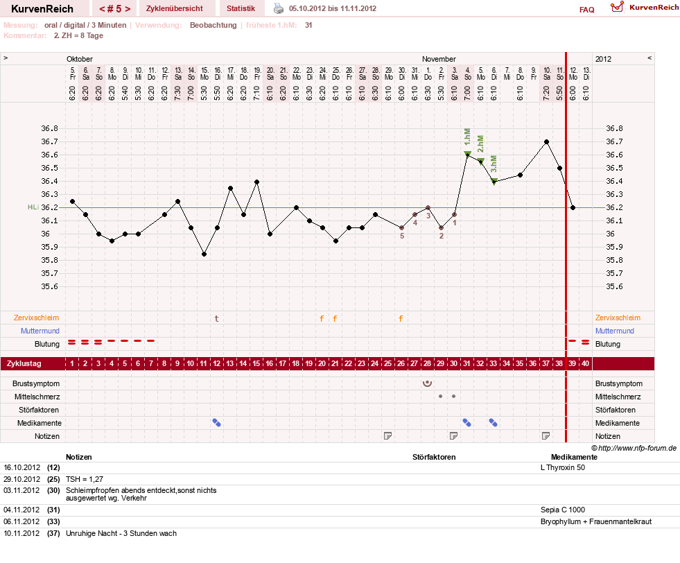 NFP-Kurve User #19449