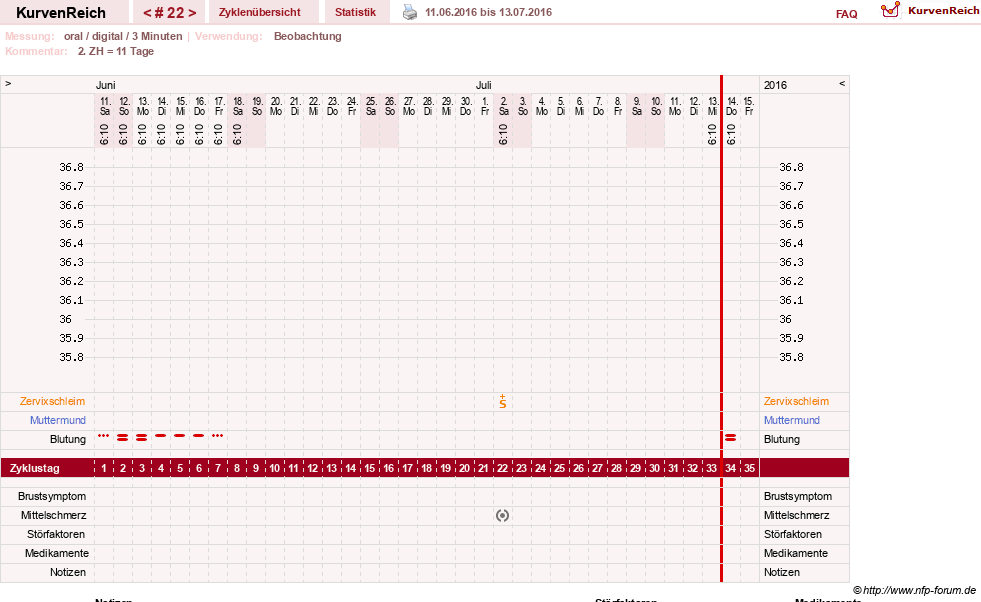NFP-Kurve User #19449