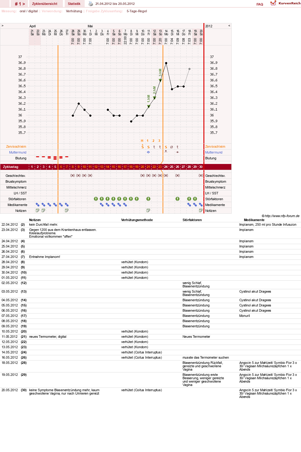NFP-Kurve User #19506