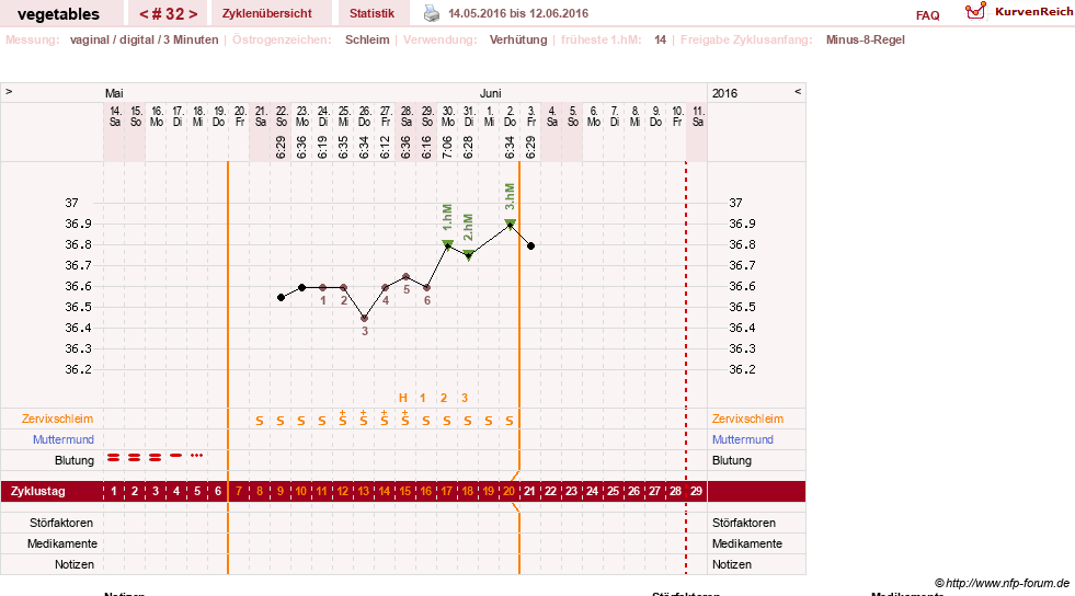 NFP-Kurve User #19520