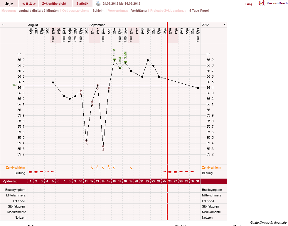 NFP-Kurve User #19949