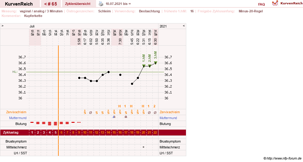 NFP-Kurve User #19994