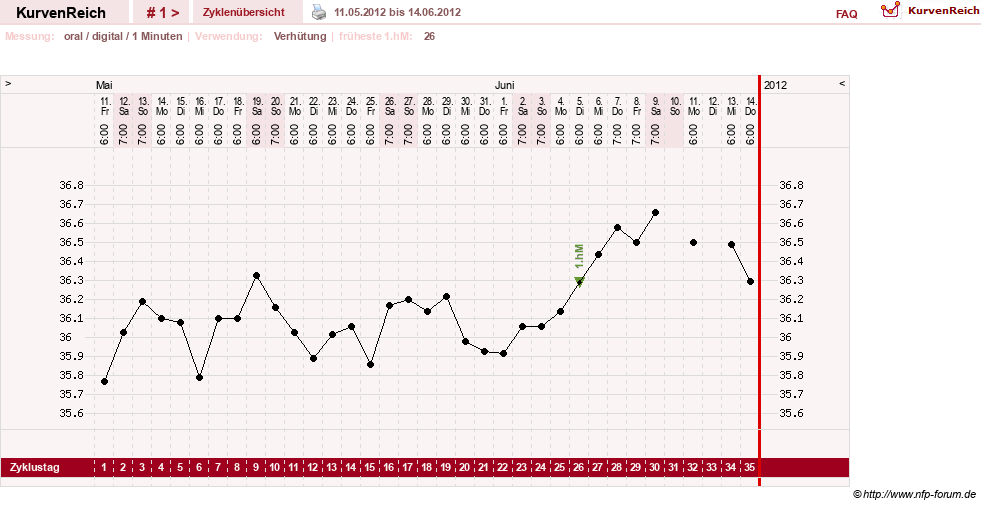 NFP-Kurve User #20120