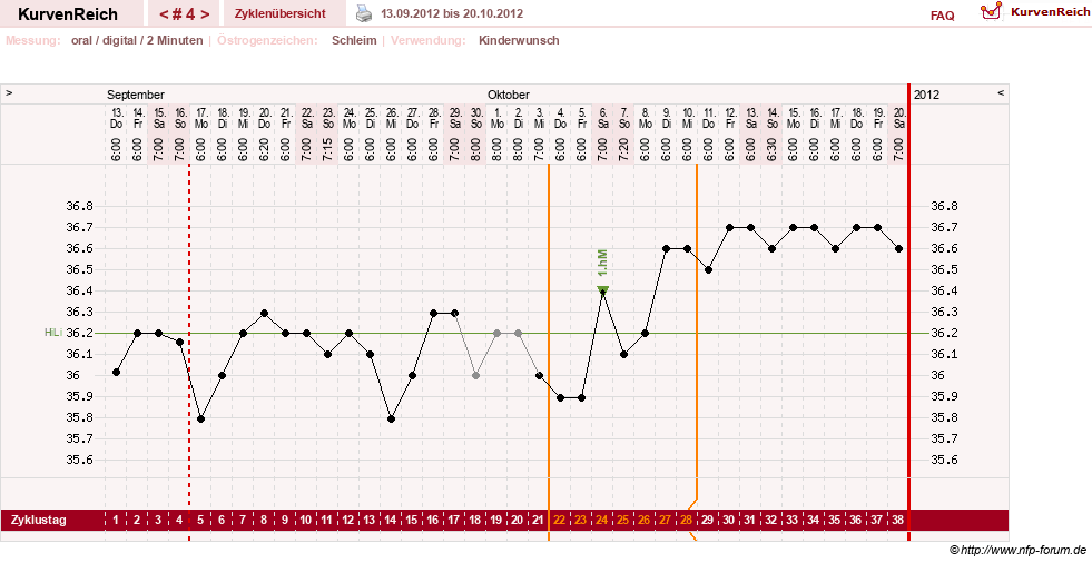 NFP-Kurve User #20120