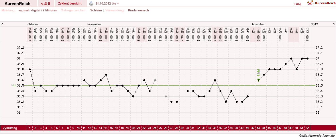NFP-Kurve User #20120