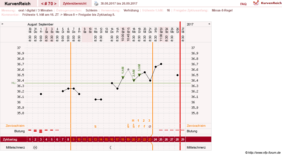 NFP-Kurve User #20196