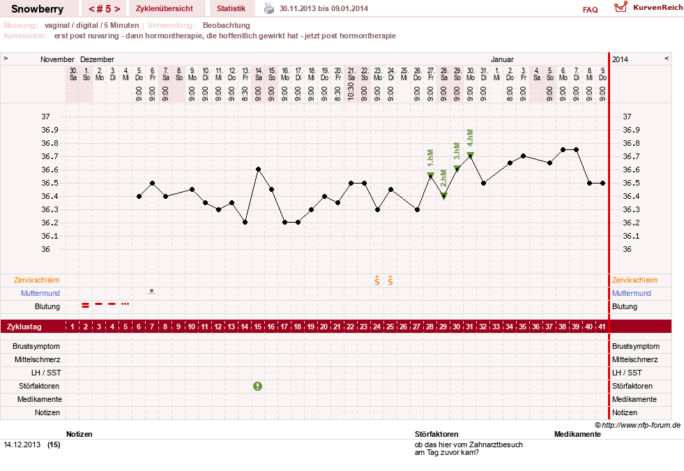 NFP-Kurve User #20525