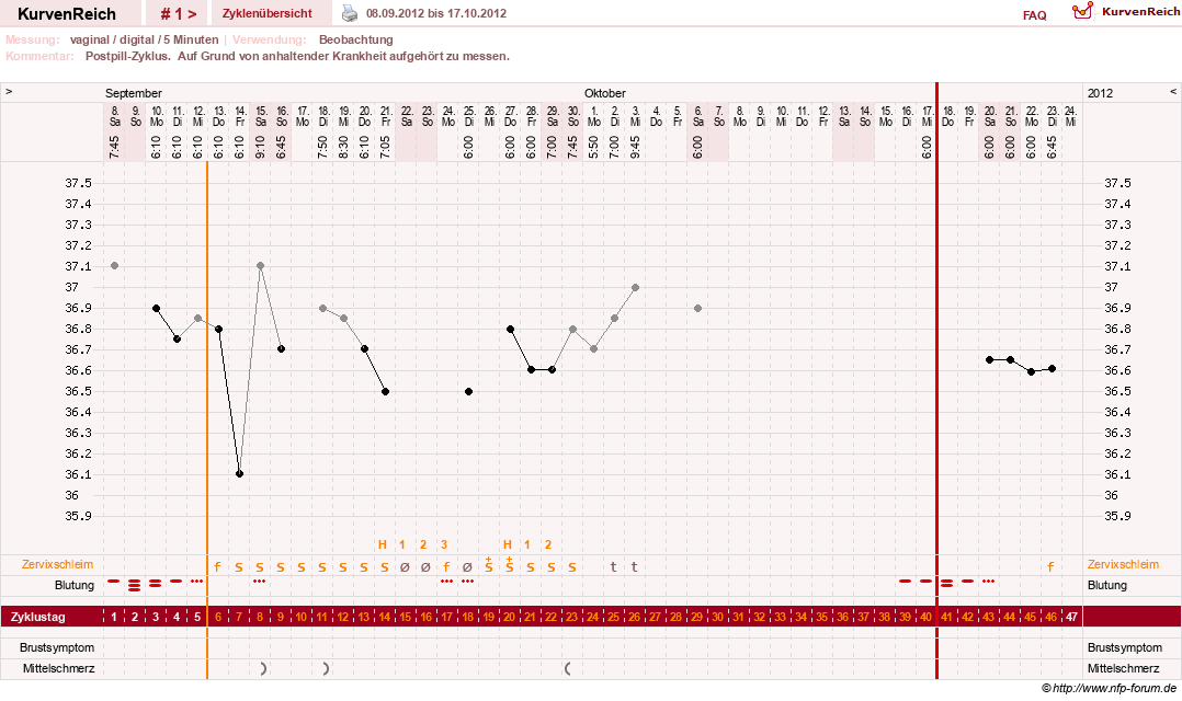 NFP-Kurve User #20763