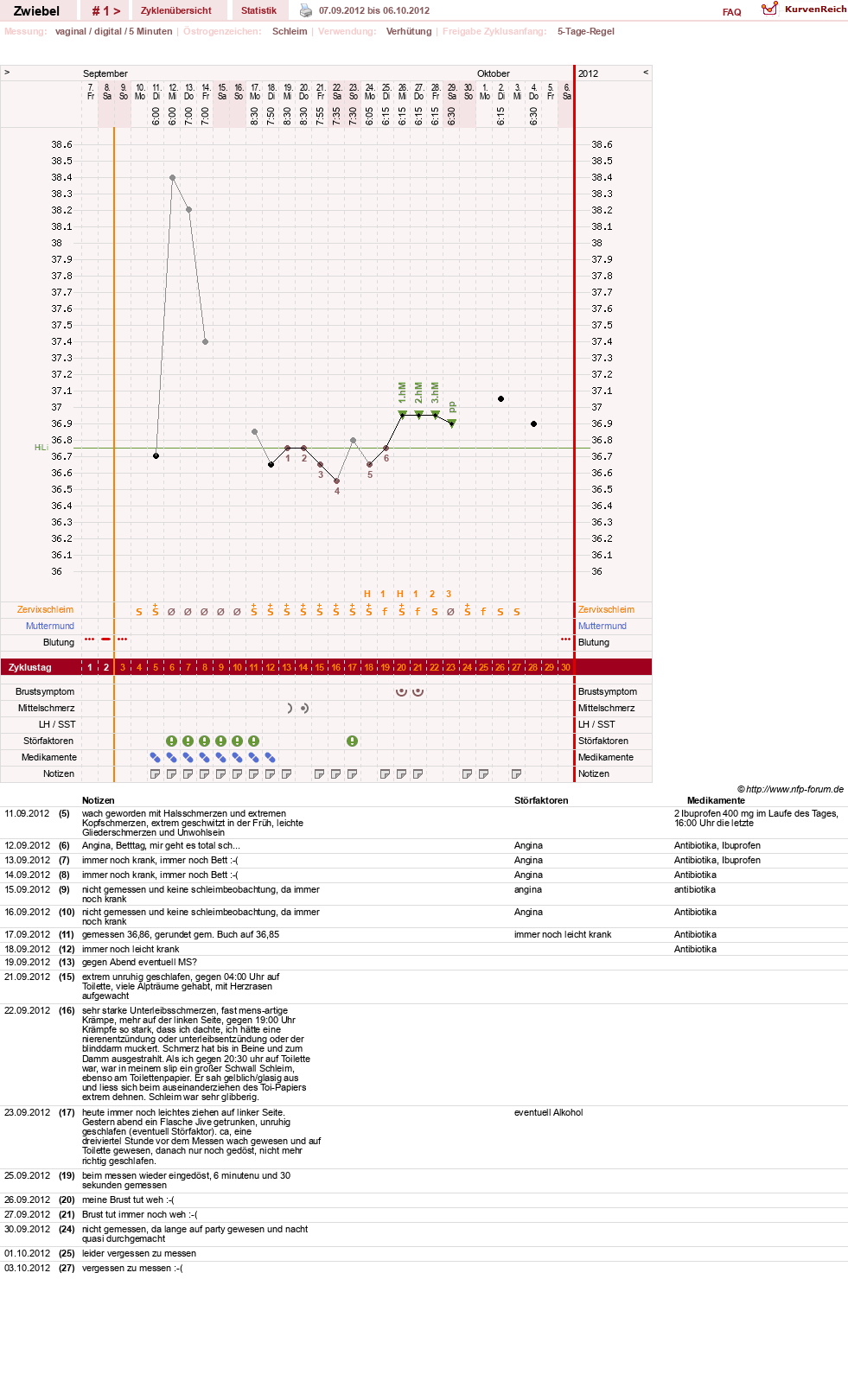 NFP-Kurve User #20902