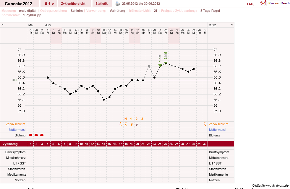 NFP-Kurve User #20941