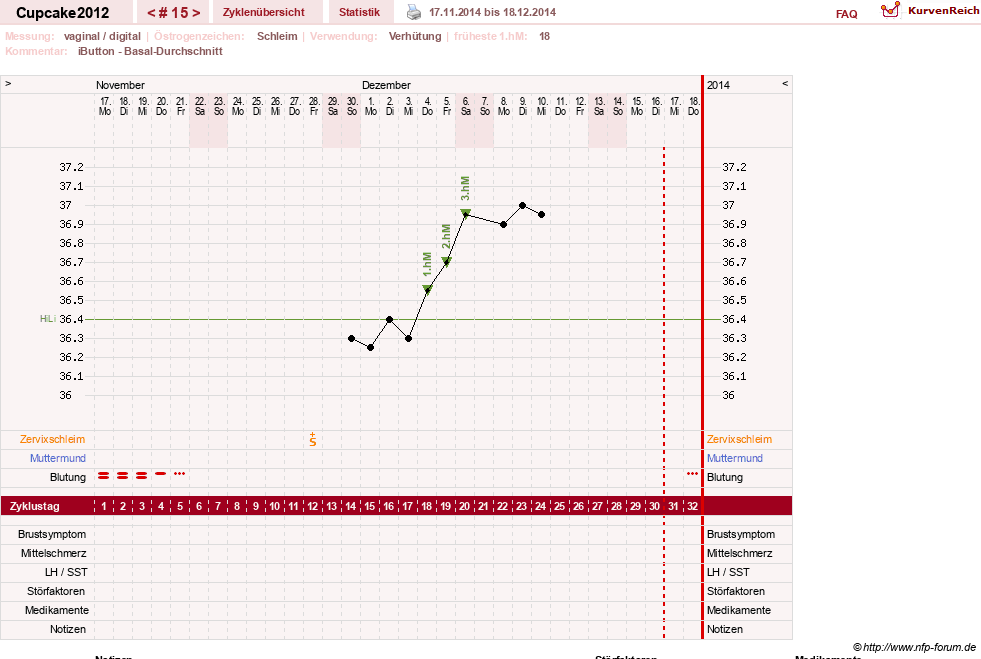 NFP-Kurve User #20941