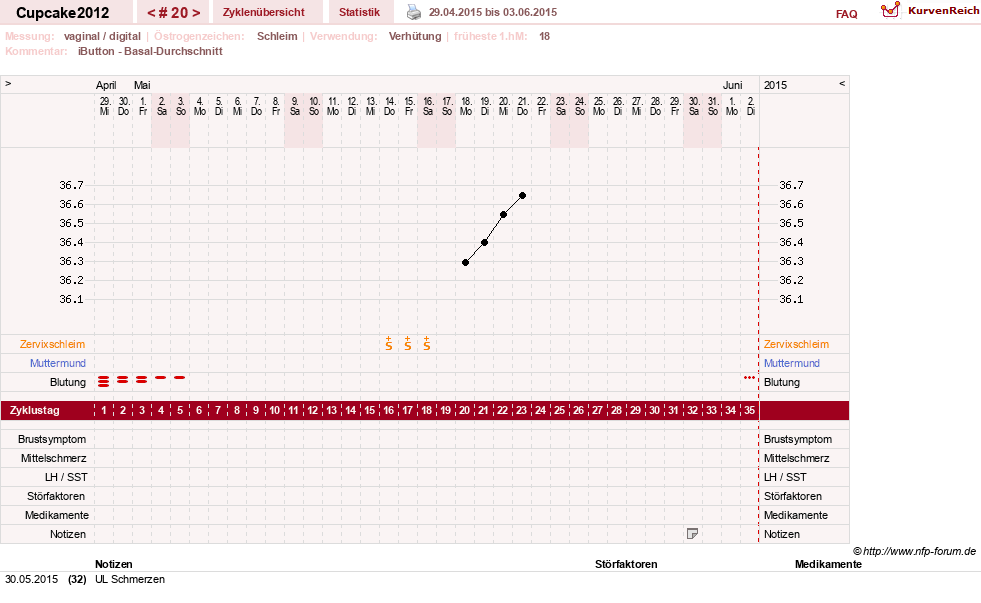 NFP-Kurve User #20941