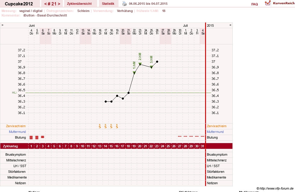 NFP-Kurve User #20941