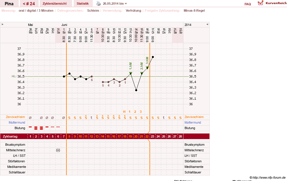 NFP-Kurve User #21272