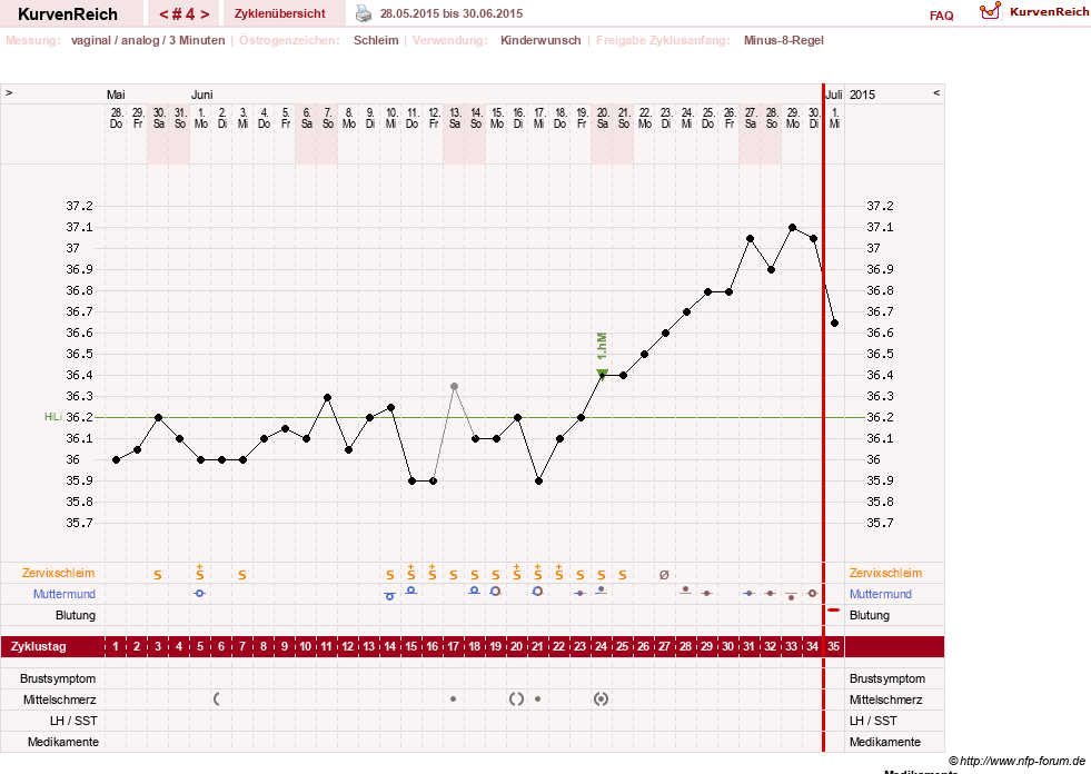 NFP-Kurve User #21334