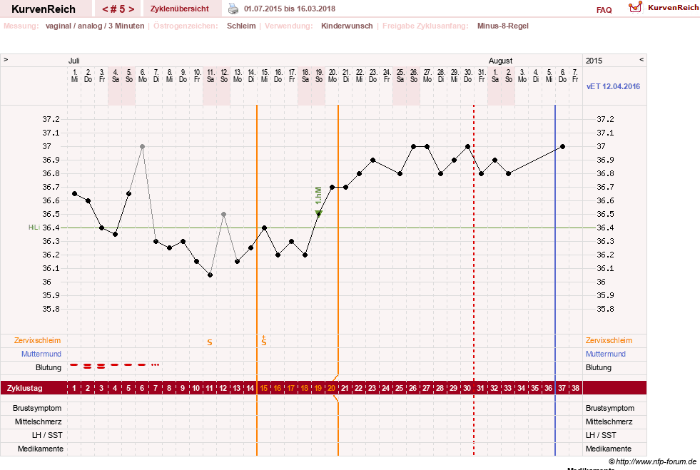 NFP-Kurve User #21334