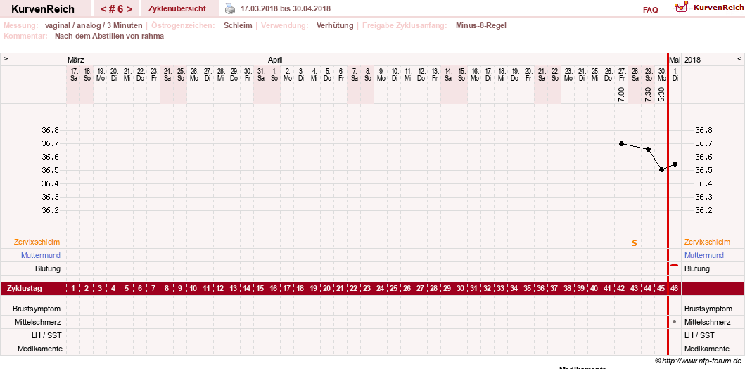 NFP-Kurve User #21334