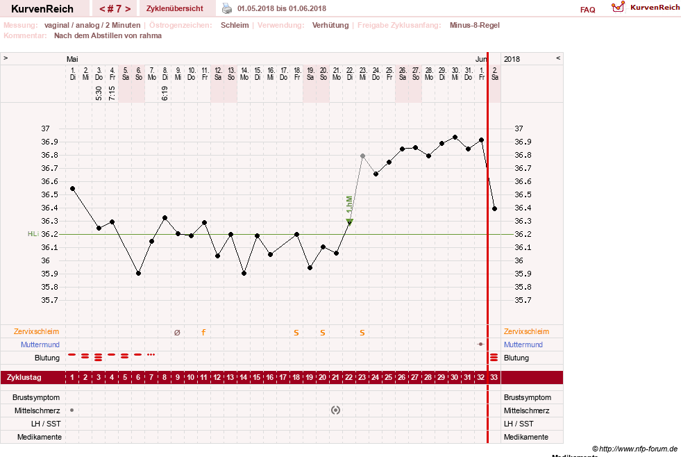 NFP-Kurve User #21334
