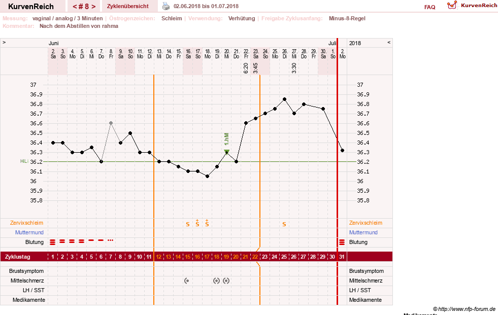 NFP-Kurve User #21334