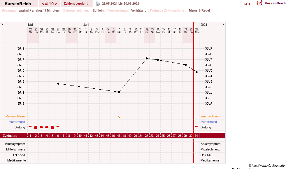 NFP-Kurve User #21334