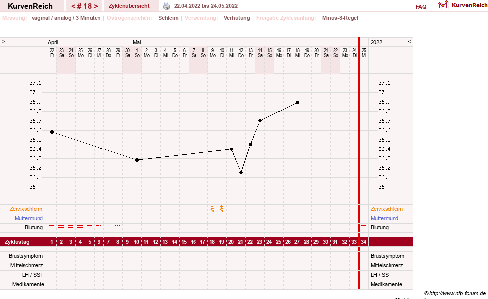 NFP-Kurve User #21334