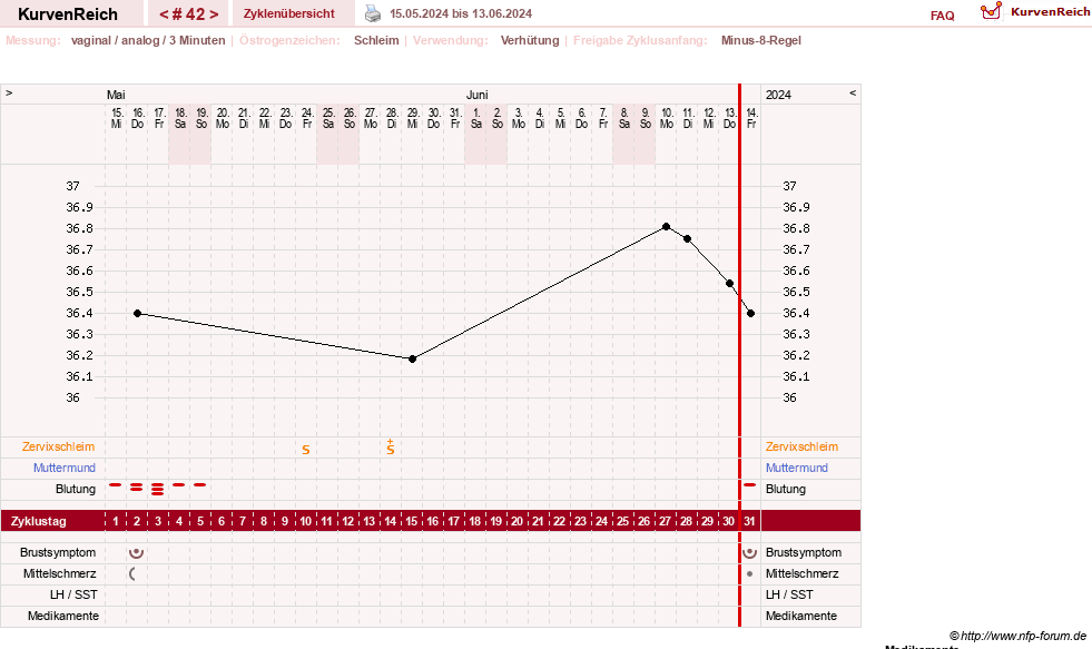 NFP-Kurve User #21334