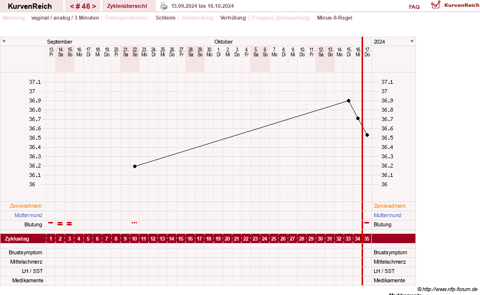 NFP-Kurve User #21334
