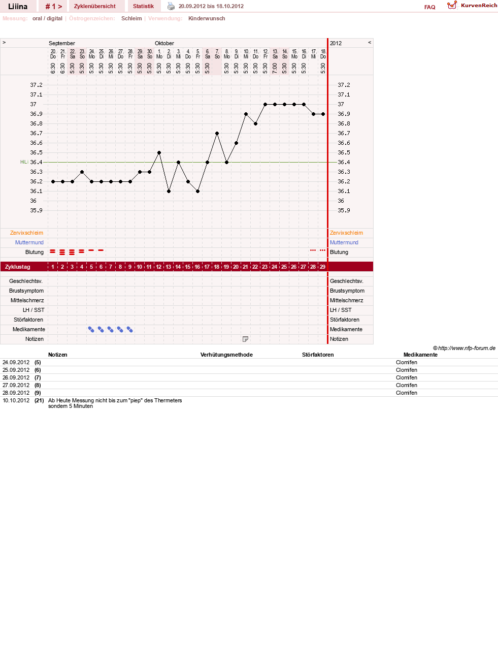 NFP-Kurve User #21343