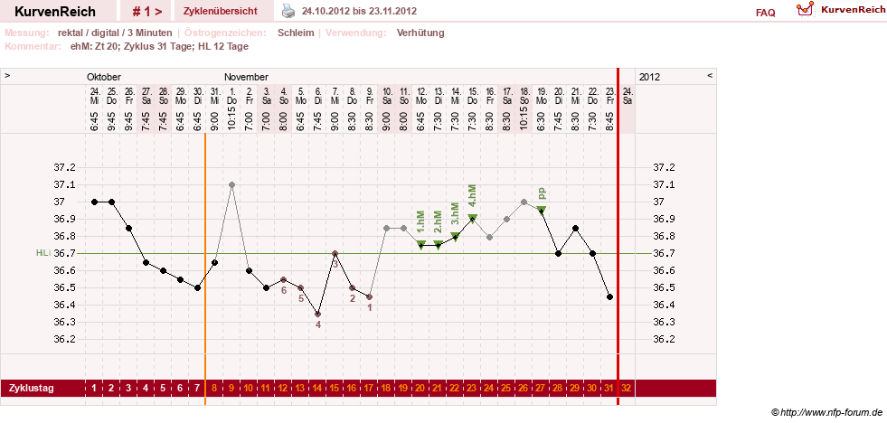 NFP-Kurve User #21422