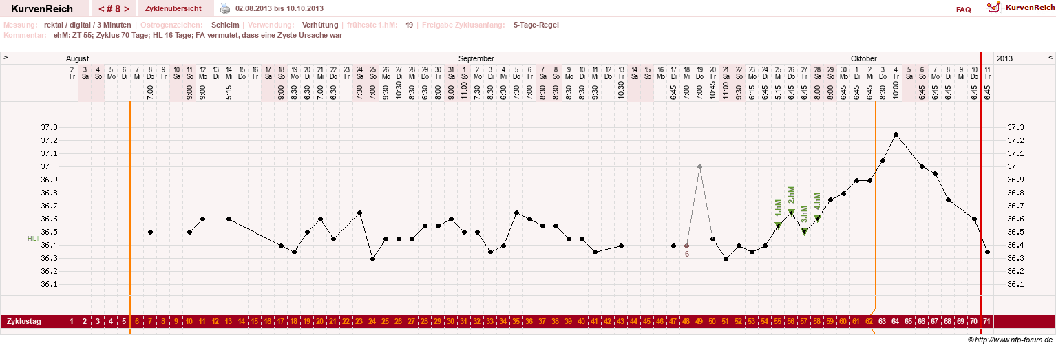NFP-Kurve User #21422