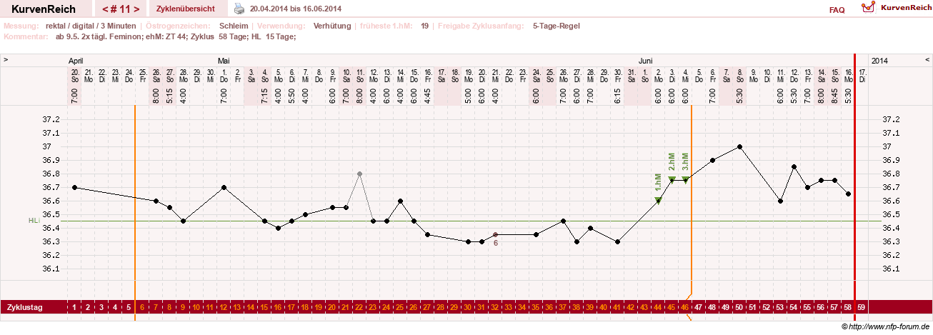 NFP-Kurve User #21422