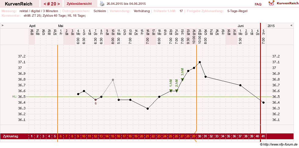 NFP-Kurve User #21422