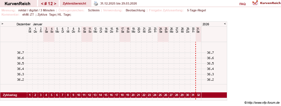 NFP-Kurve User #21422
