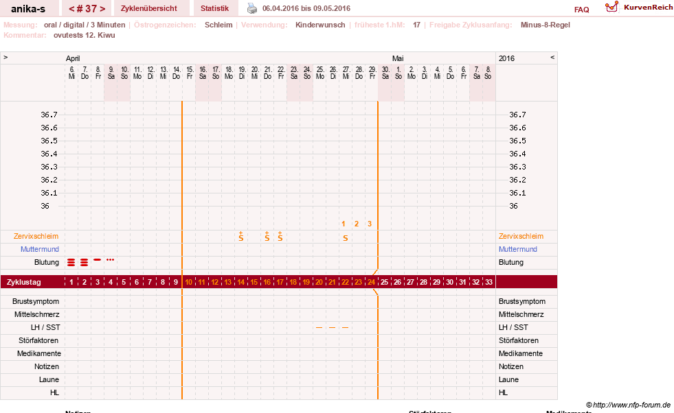 NFP-Kurve User #21449